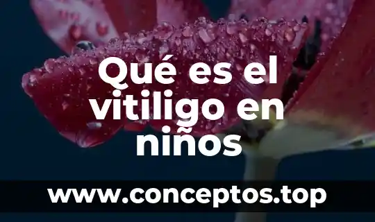 Qué es el vitiligo en niños