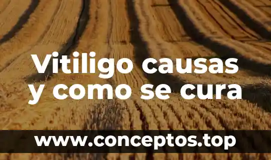 Albahaca que es que cura todo sobre esta planta 6 Vitiligo causas y como se cura